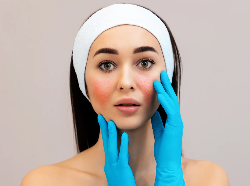 Let's Talk About Sensitive Skin...